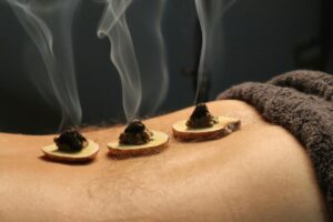 Home page Close-up of traditional moxibustion therapy with smoke rising from moxa cones.