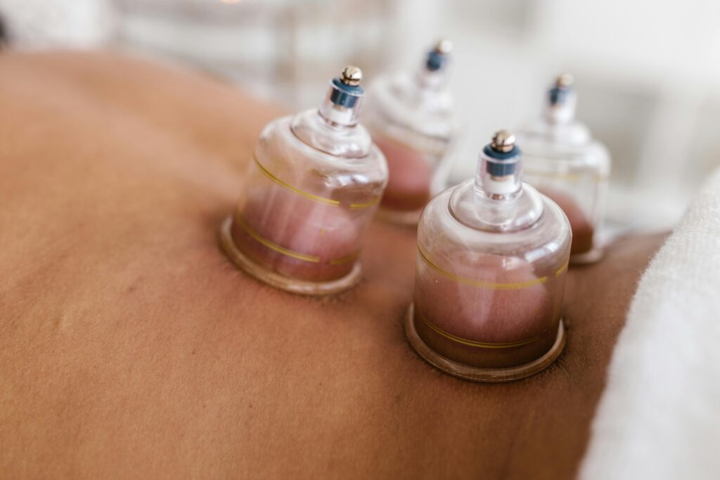 Home page Detailed image of cupping therapy on a person